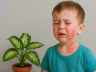 Как обычное комнатное растение стало причиной ожогов у ребенка