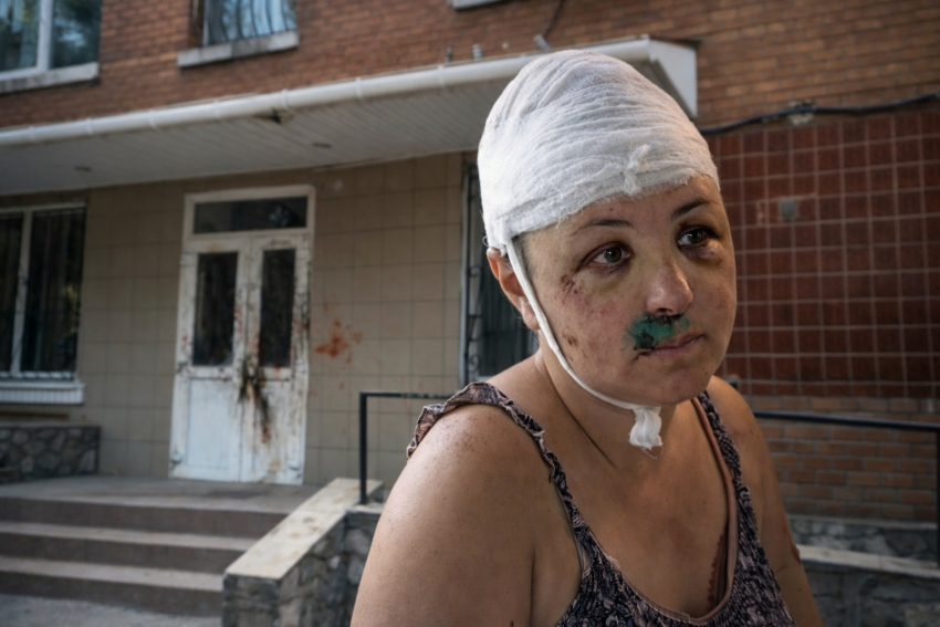 Изнасиловали, разбили череп и бросили: как история из Николаевской области потрясла Херсонщину