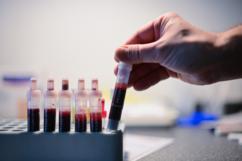 Вспышка ВИЧ-инфекции среди девушек произошла на Херсонщине из-за военных - новый фейк ВСУ