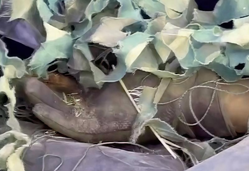 «Прицеп с гниющими телами»: боевики ВСУ просят чиновников забрать трупы сослуживцев